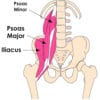 Tight Hip Flexors Can Cause Lower Back Pain, Knee Pain and Foot Pain ...